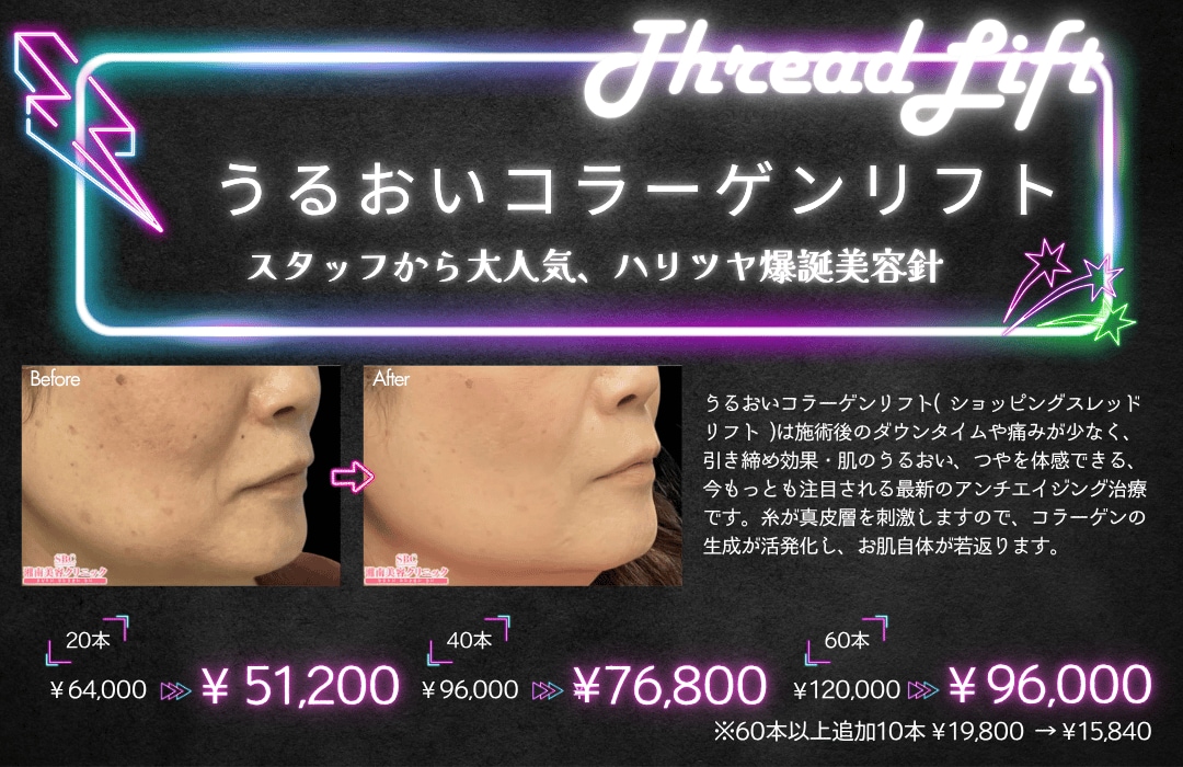 うるおいコラーゲンリフト
