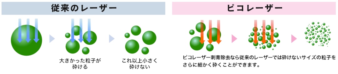 ピコレーザーの特徴