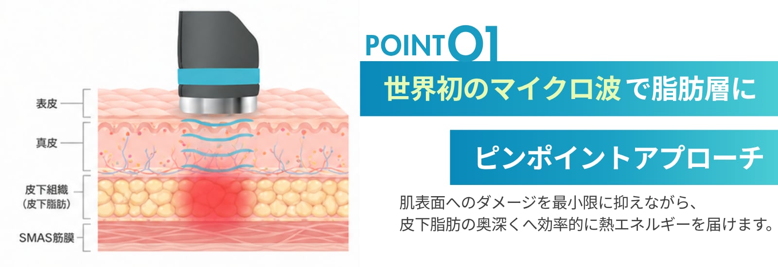 効率よく脂肪を狙い撃ち（ボリュームダウン）