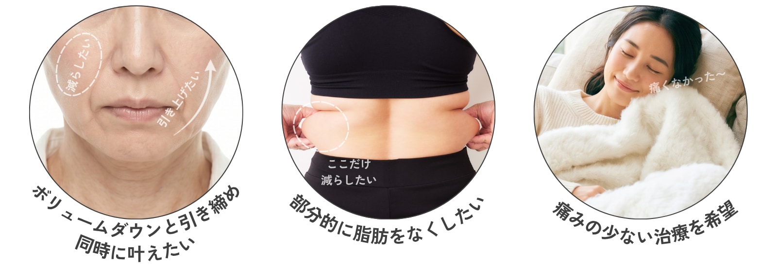 最新痩身治療「オンダリフト」はこんな方におすすめ！