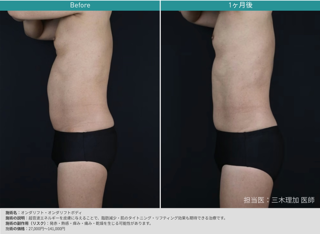 腹部が気になる方
