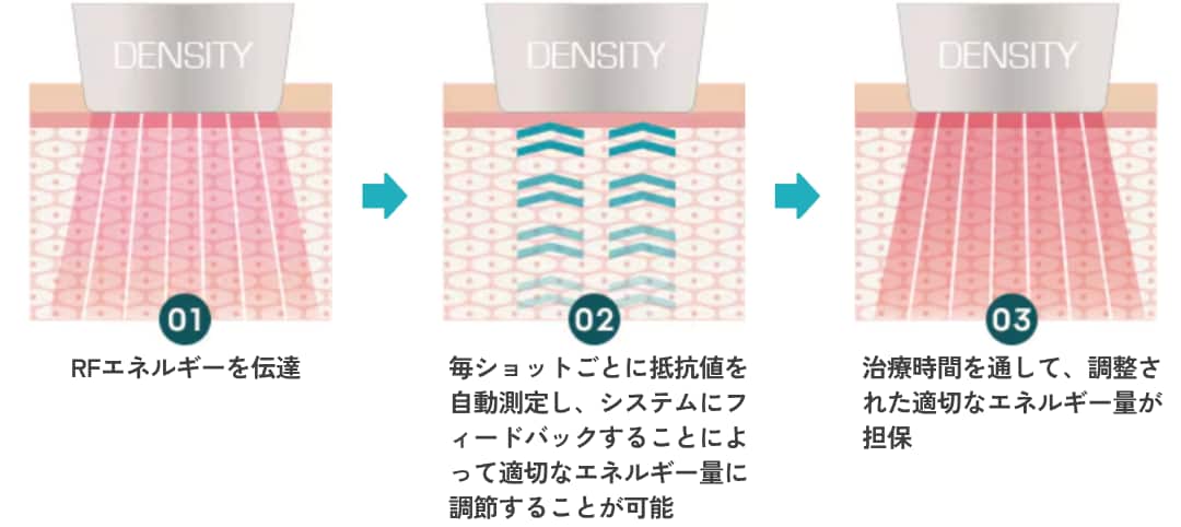 毎ショット自動調整する「リアルタイムインピーダンス機能」