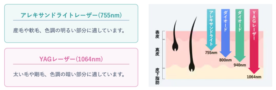 波長を選択することも可能
