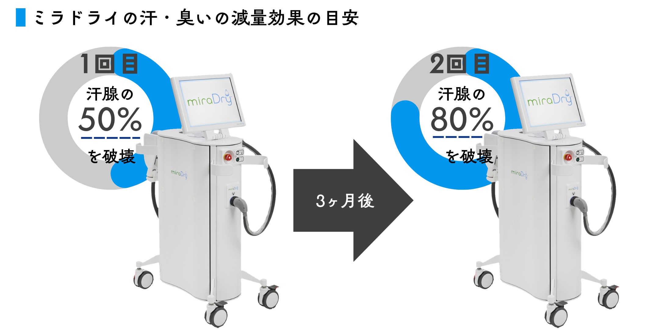 ミラドライの効果