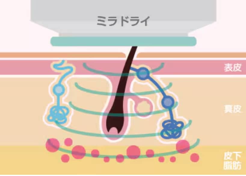 仕組み.1