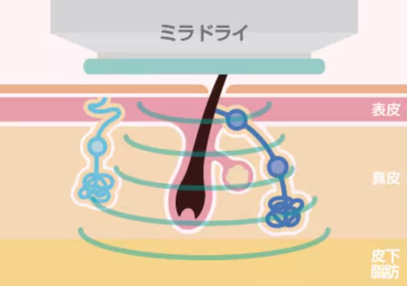 仕組み.2