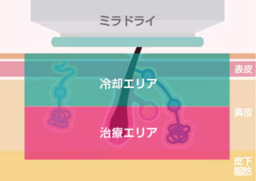 仕組み.3