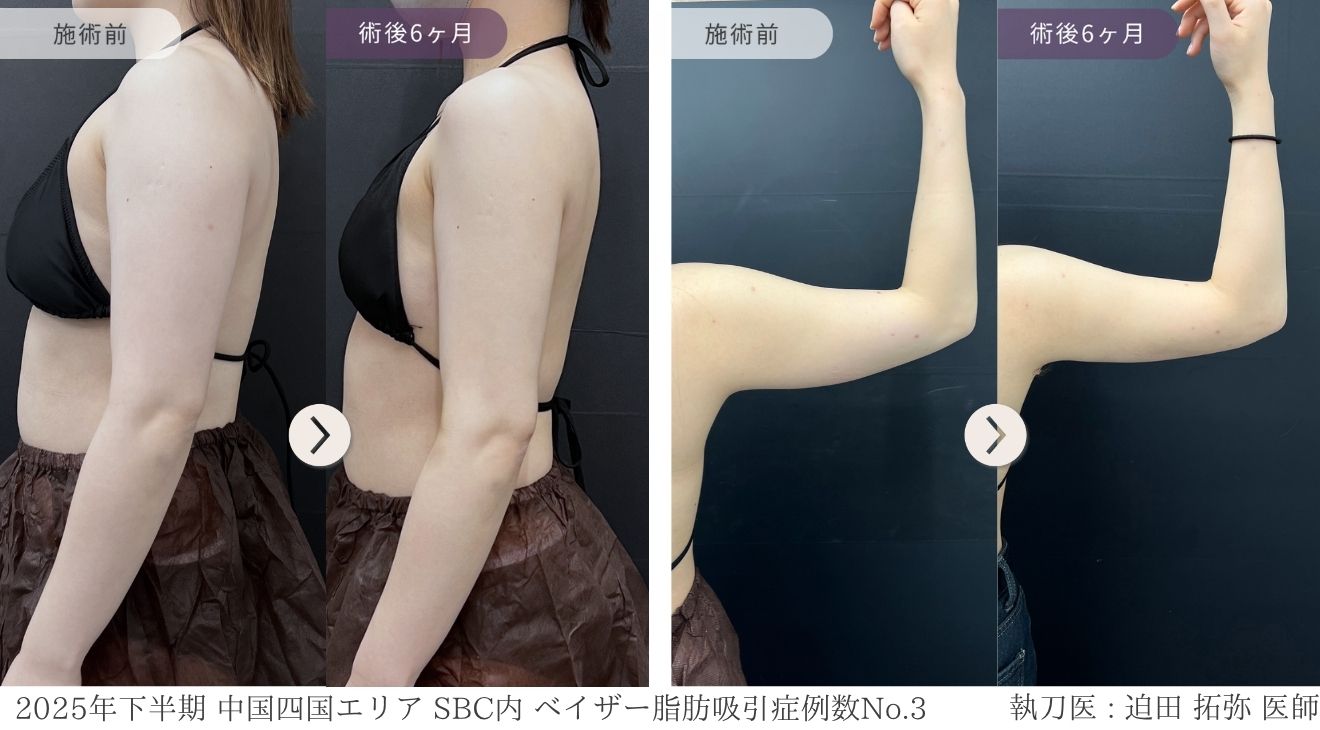 症例写真 Before After