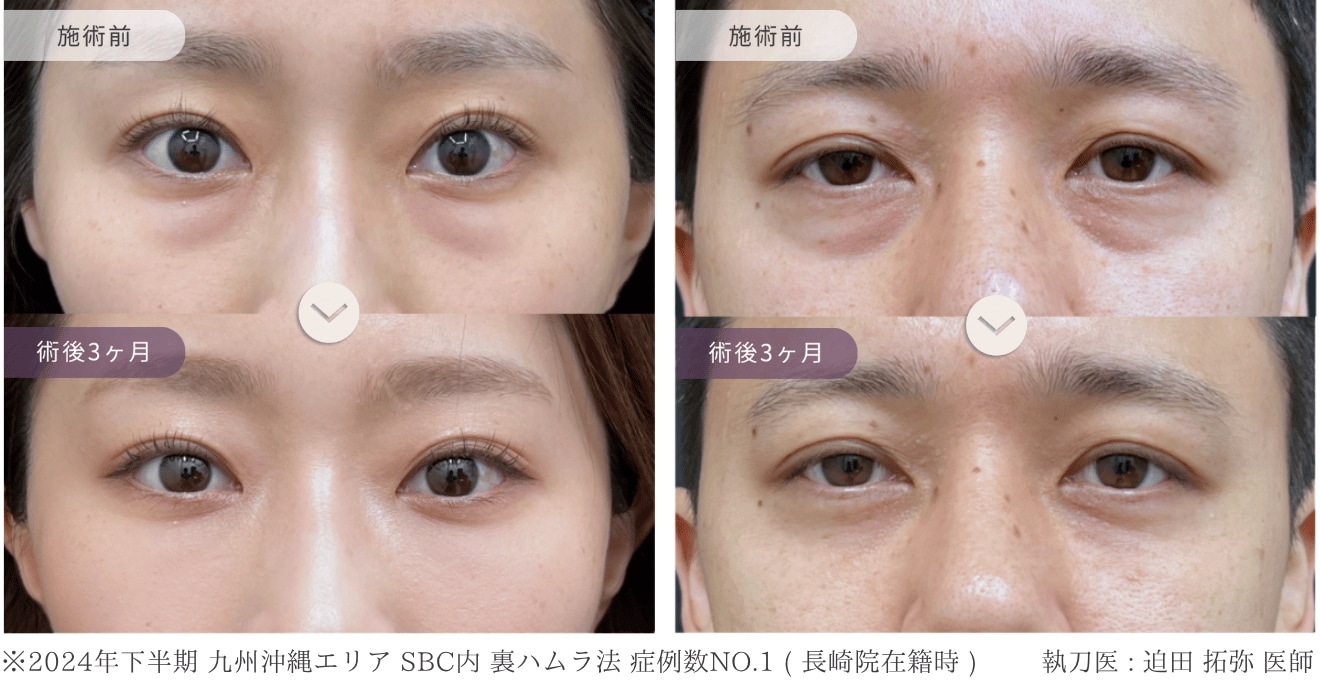 症例写真 Before After