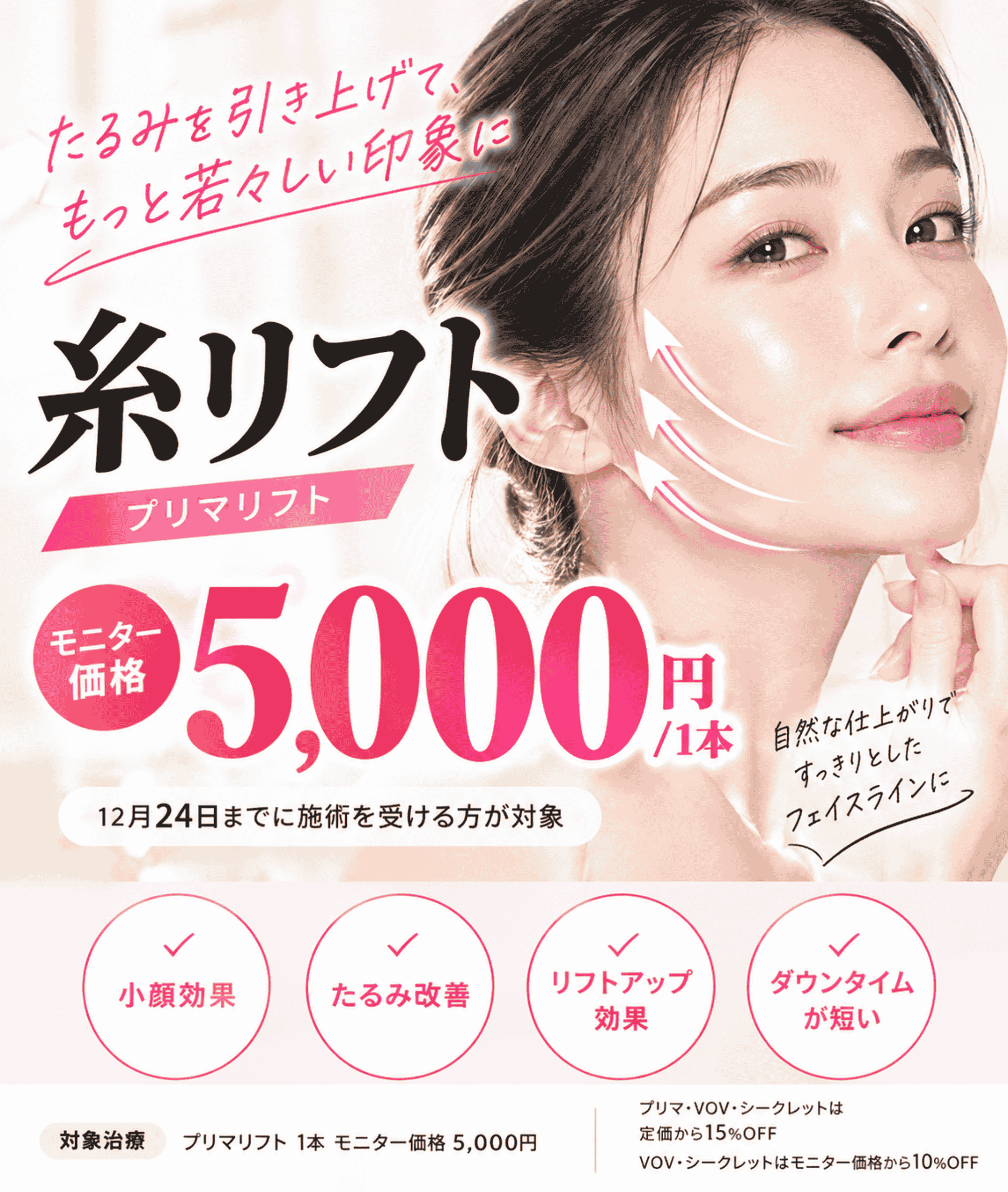 糸リフト