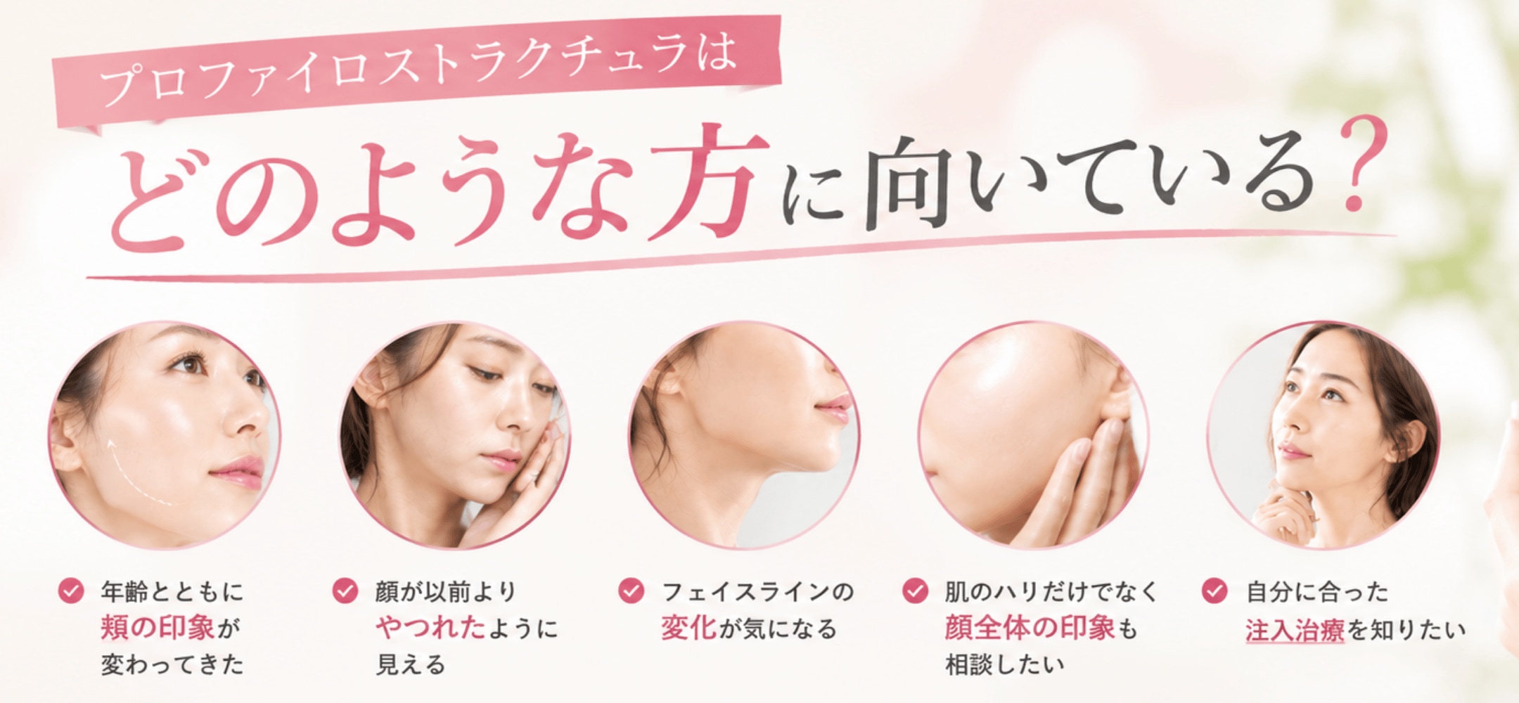 プロファイロストラクチュラの適応