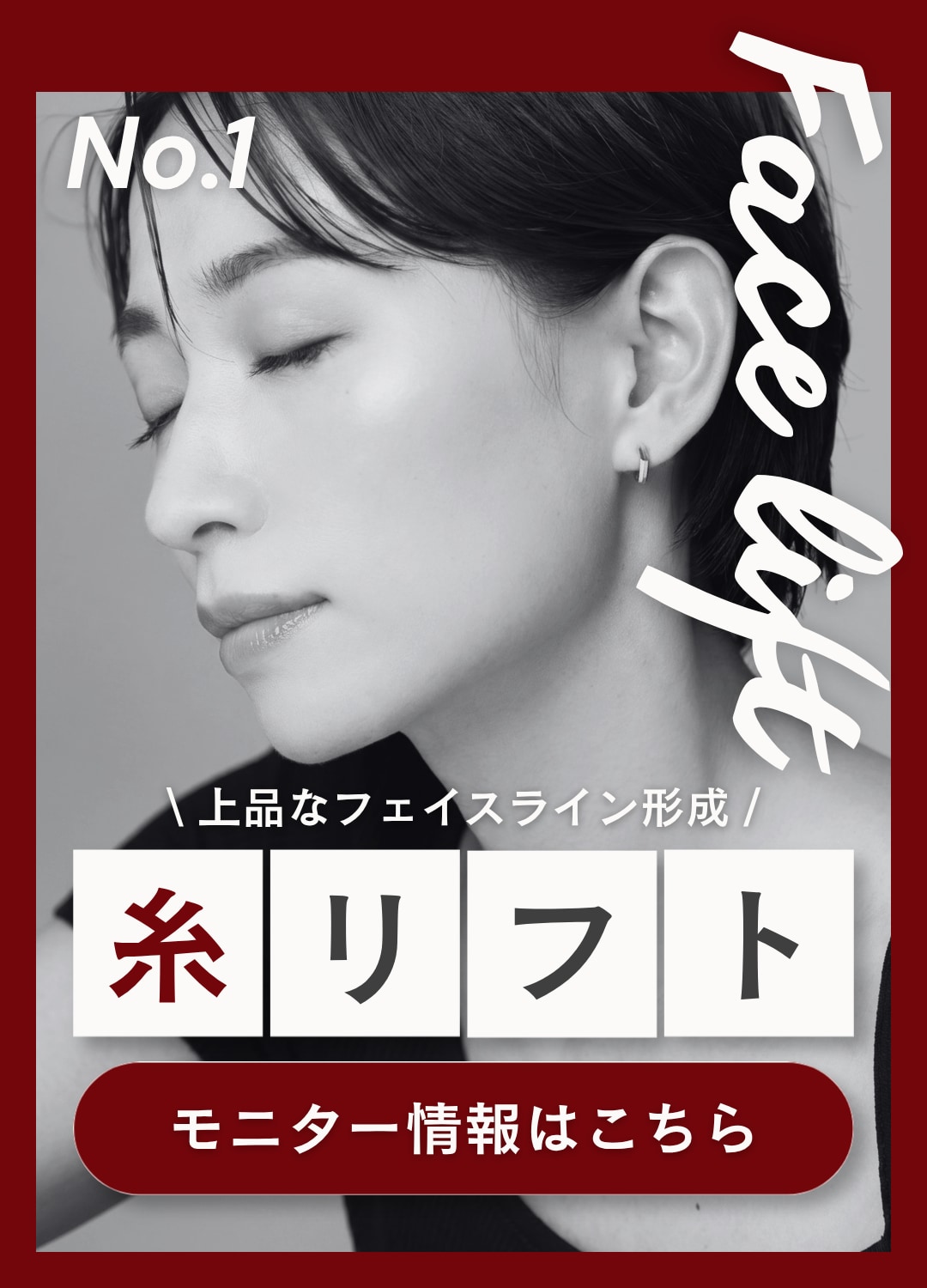 糸リフト｜上品なフェイスライン形成