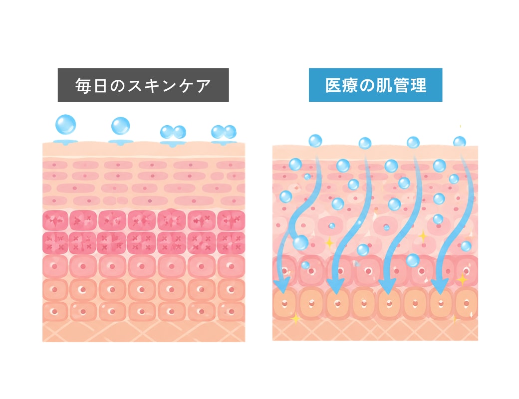 自己流ケアと医療の肌管理は何が違う？