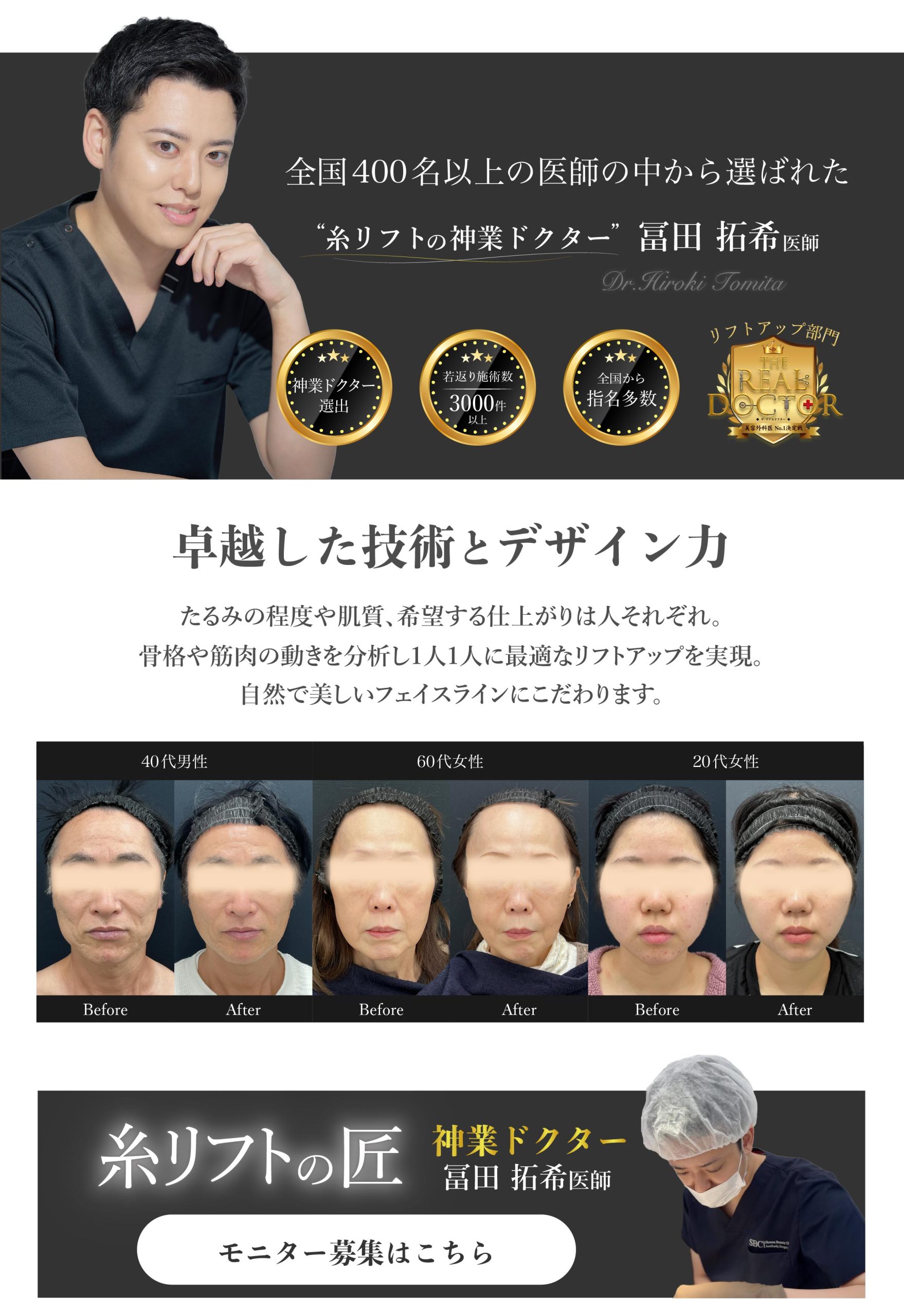 神業ドクターが贈る糸リフトによる美顔革命