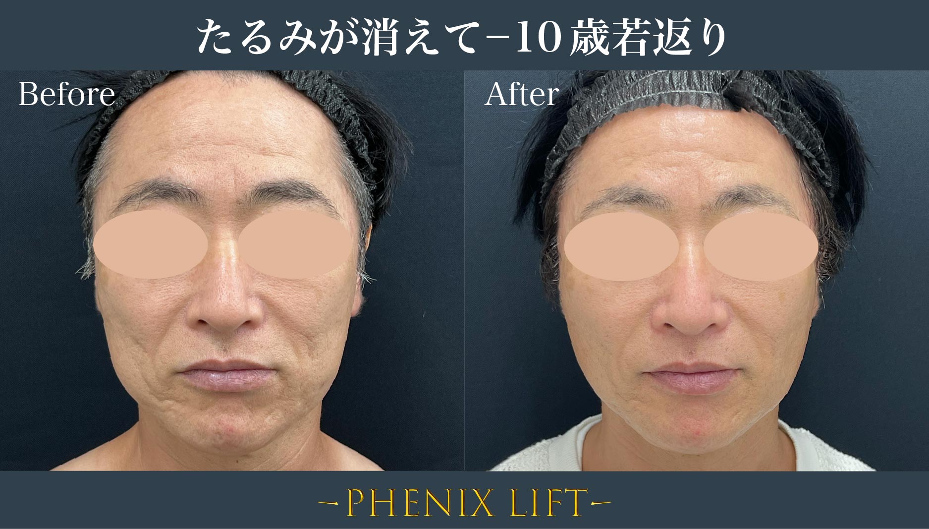 ◼︎−10歳若返り