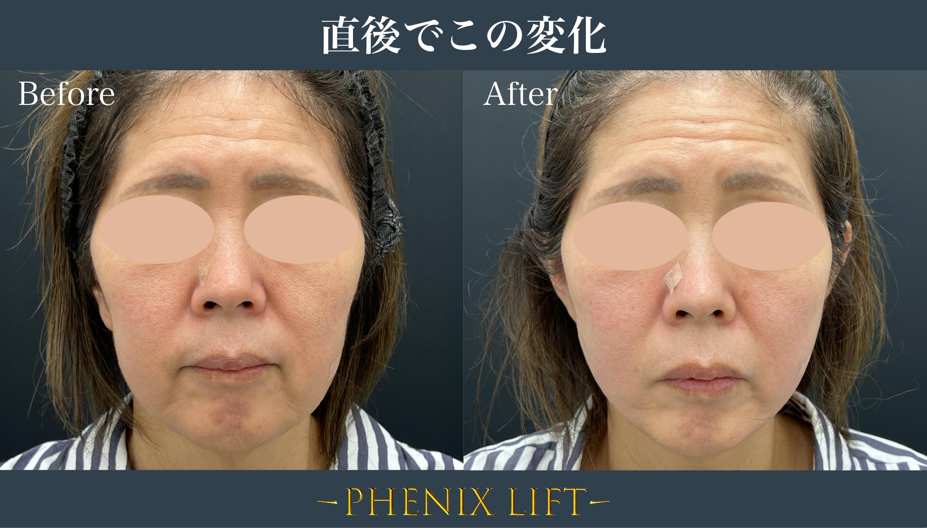 ◼︎効果即実感