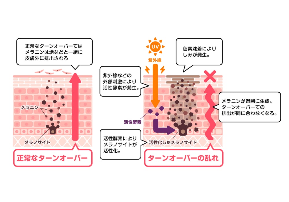 内服や外用で再発を防ぐ