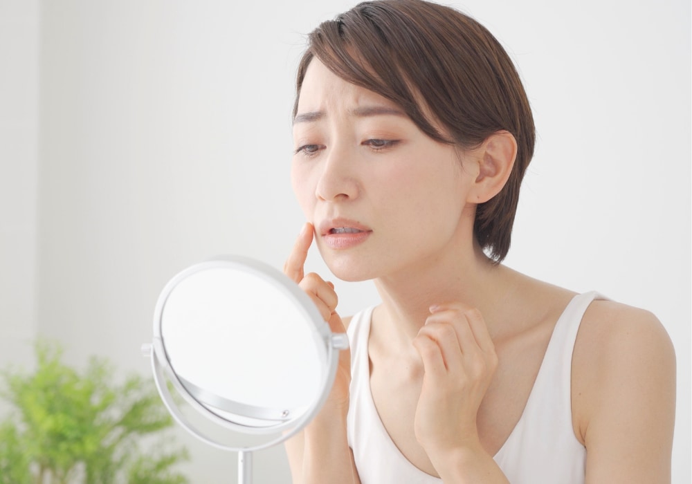 30代・40代から増えるシミのお悩み