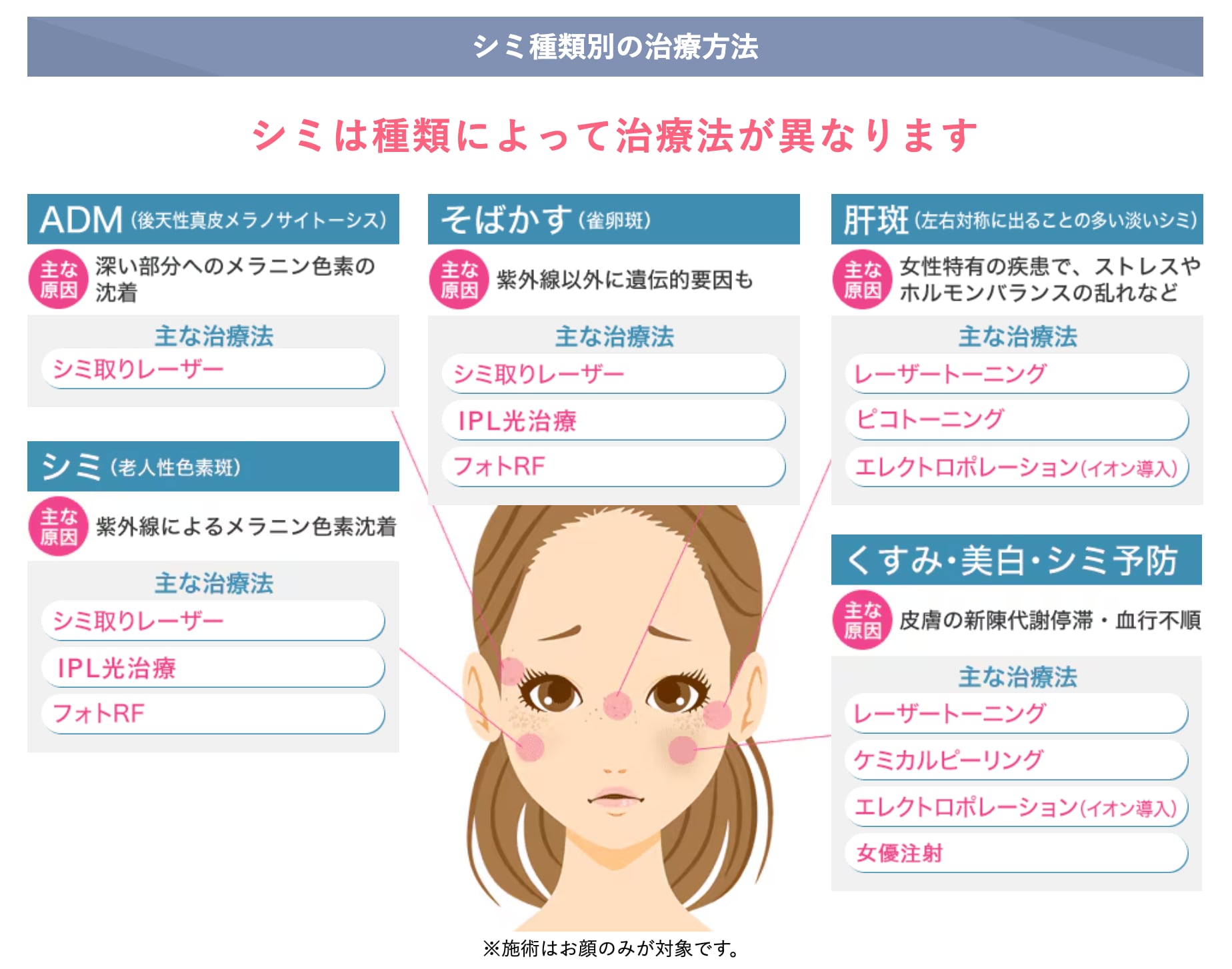 シミは種類によって治療が変わります