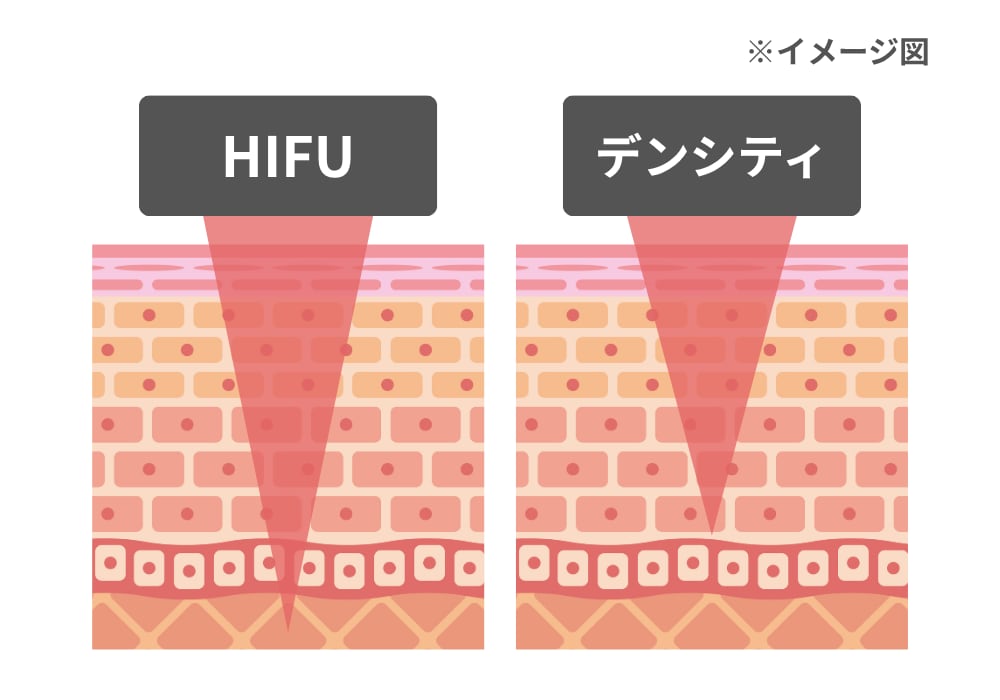 たるみ治療ならどっちがいい？