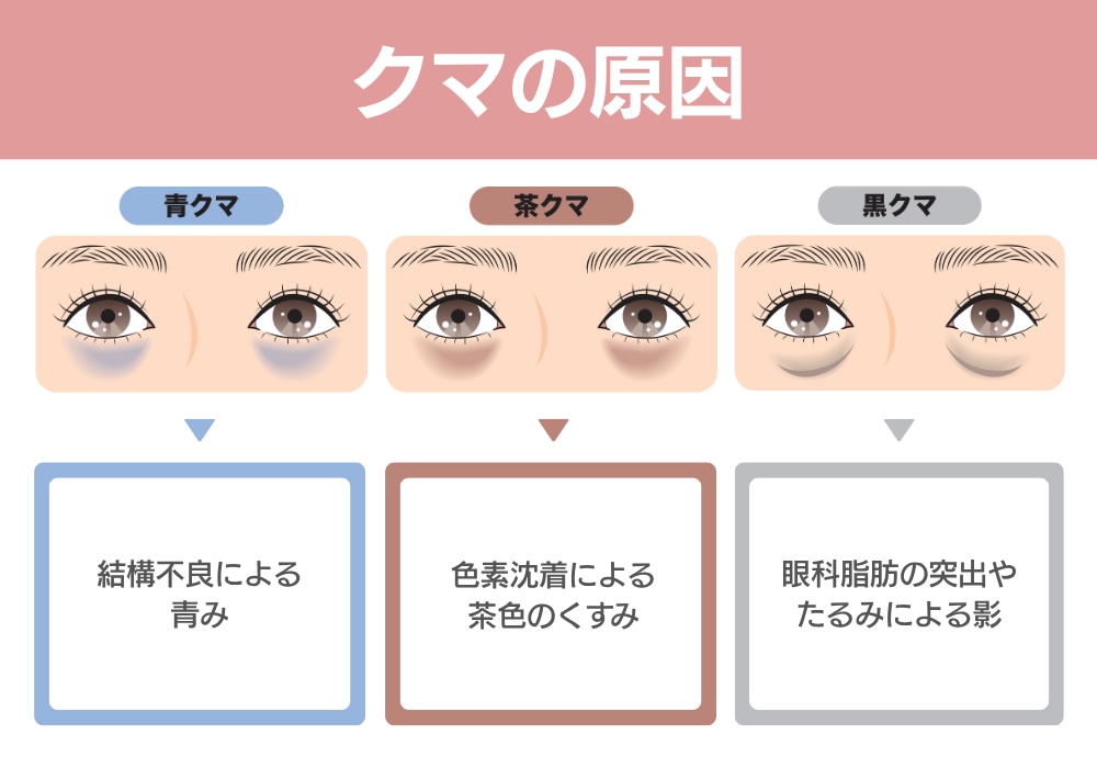 クマの種類と対処法