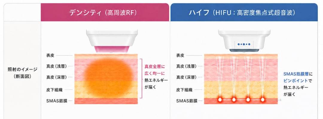 どちらが良いの？