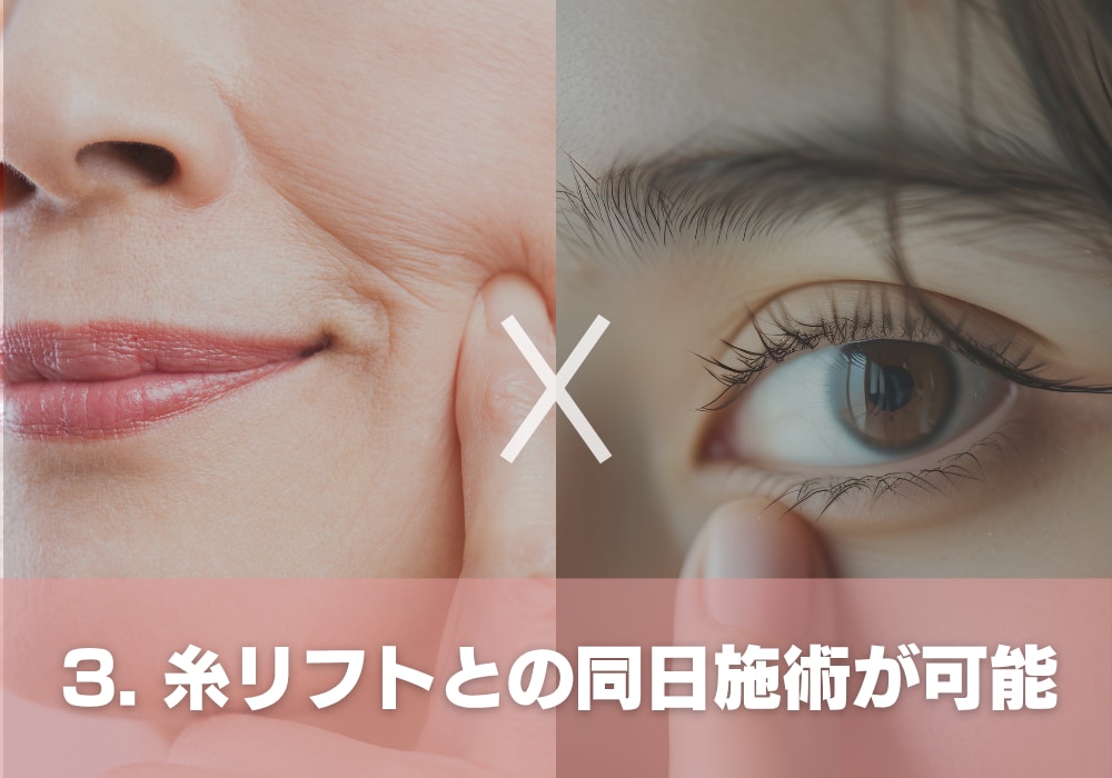 3. 糸リフトとの同日施術が可能