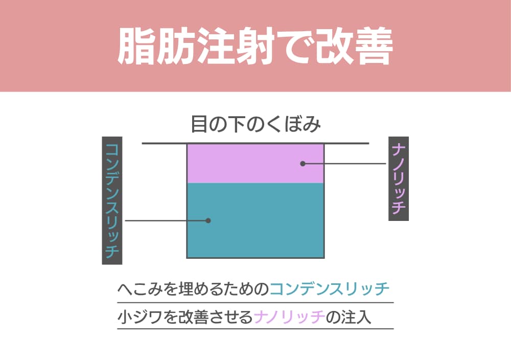 脂肪注射で改善