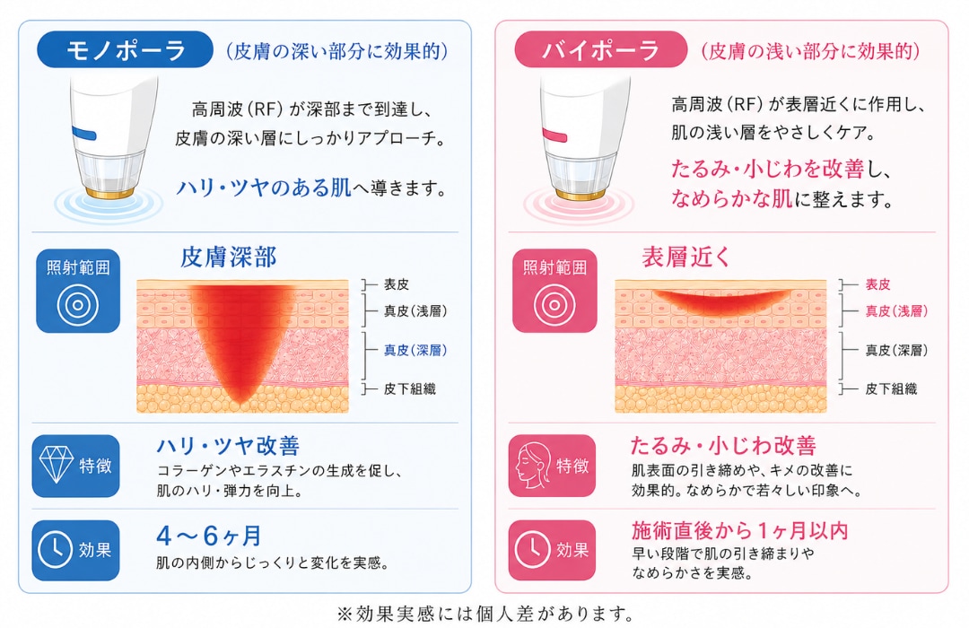モノバイチップとは
