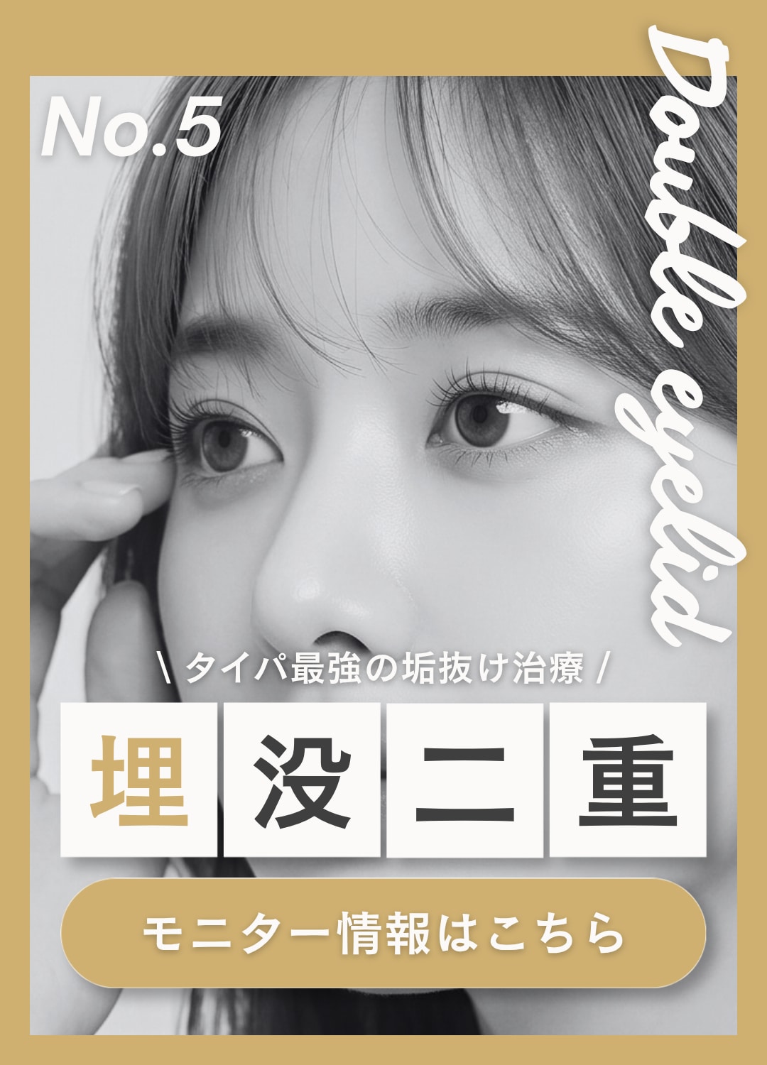 埋没二重｜タイパ最強の垢抜け治療