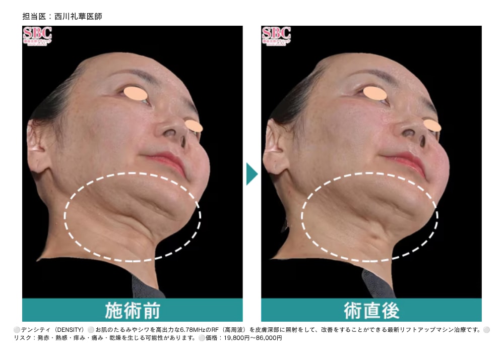 症例紹介