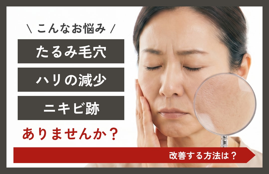 ダーマペンを越谷で｜ニキビ跡・毛穴の肌再生治療｜SBC南越谷院