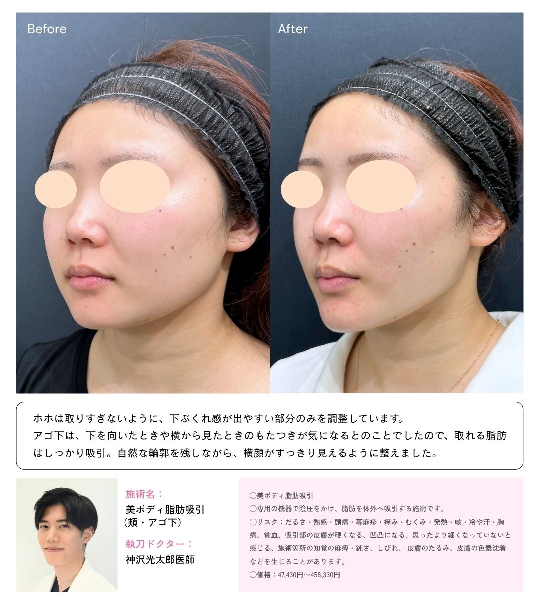 20代女性