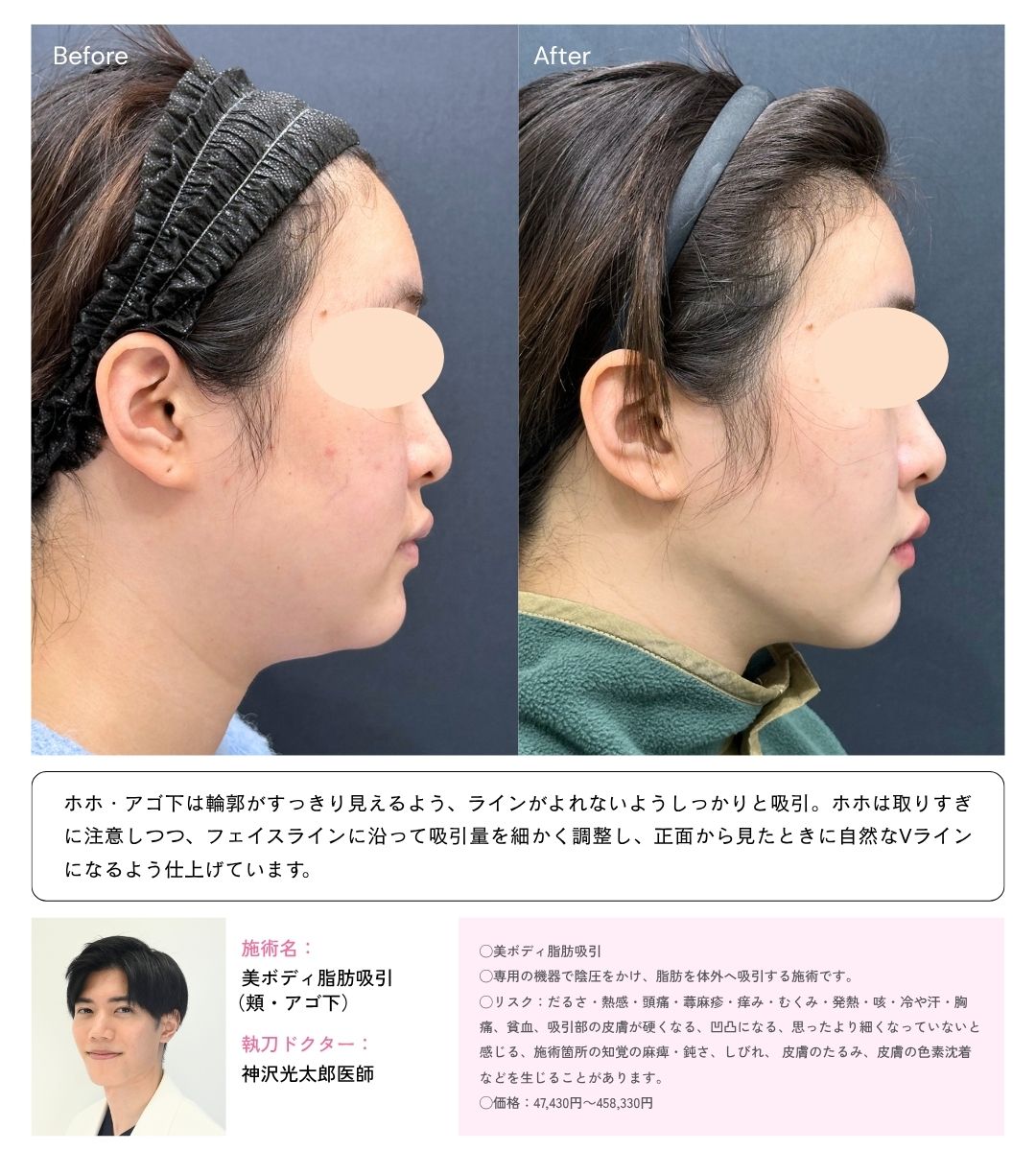 20代女性