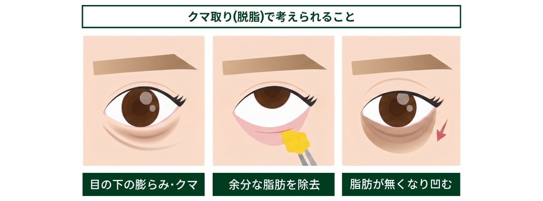 クマ取り(脱脂単体)で考えられること