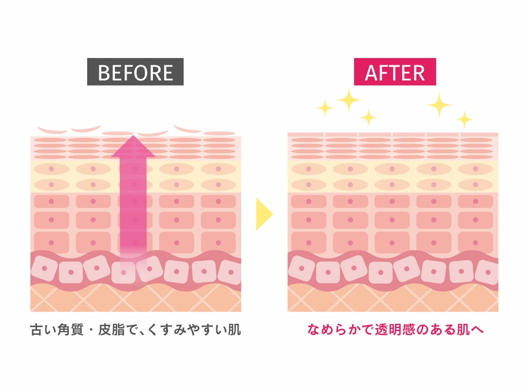 様々なお悩みに対応｜ピーリングが選ばれ続けている理由を解説