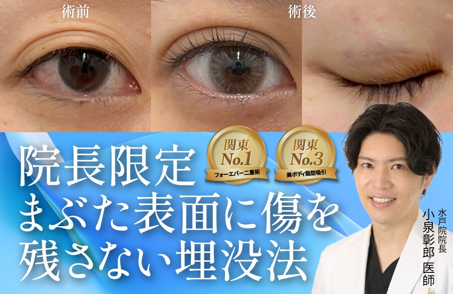 【まぶた表面に傷なし】バレたくない方におすすめ！医師歴12年のベテラン院長だけができる二重埋没法
