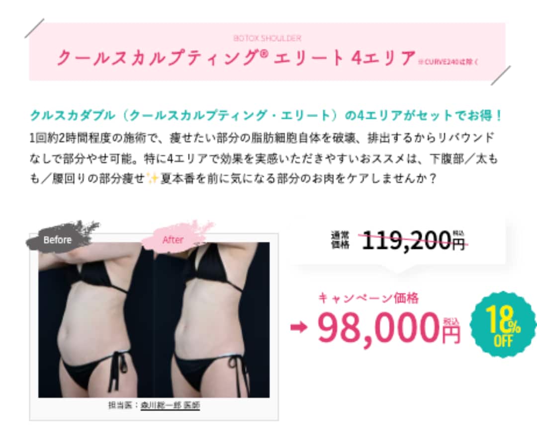 クールスカルプティング