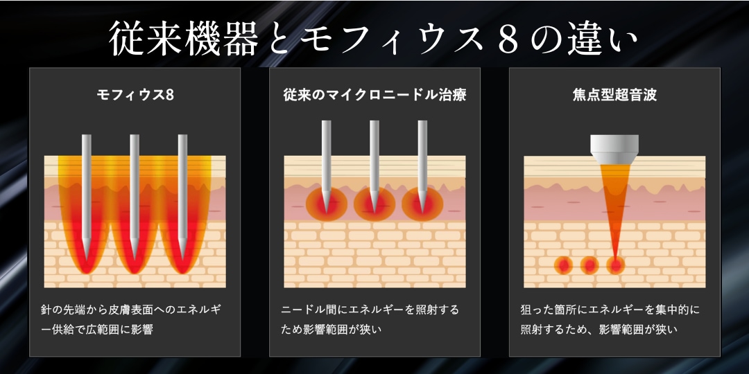 モフィウスは広範囲に照射ができる✨