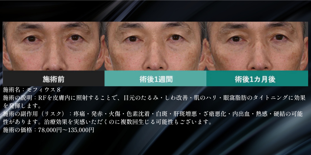 目の下の症例