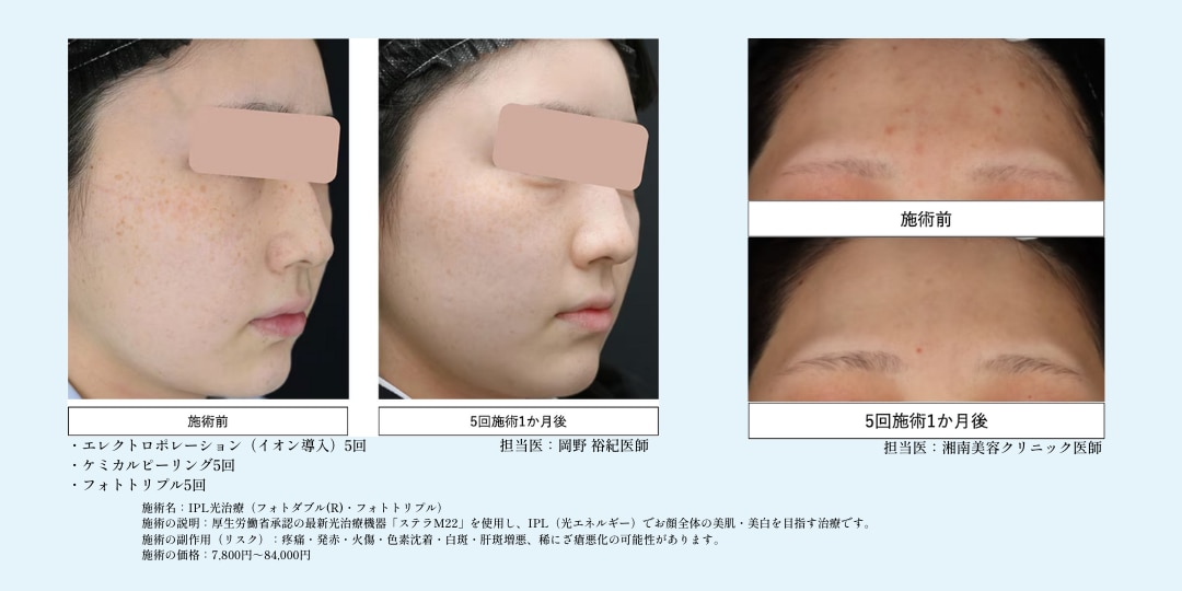 📷症例写真📷