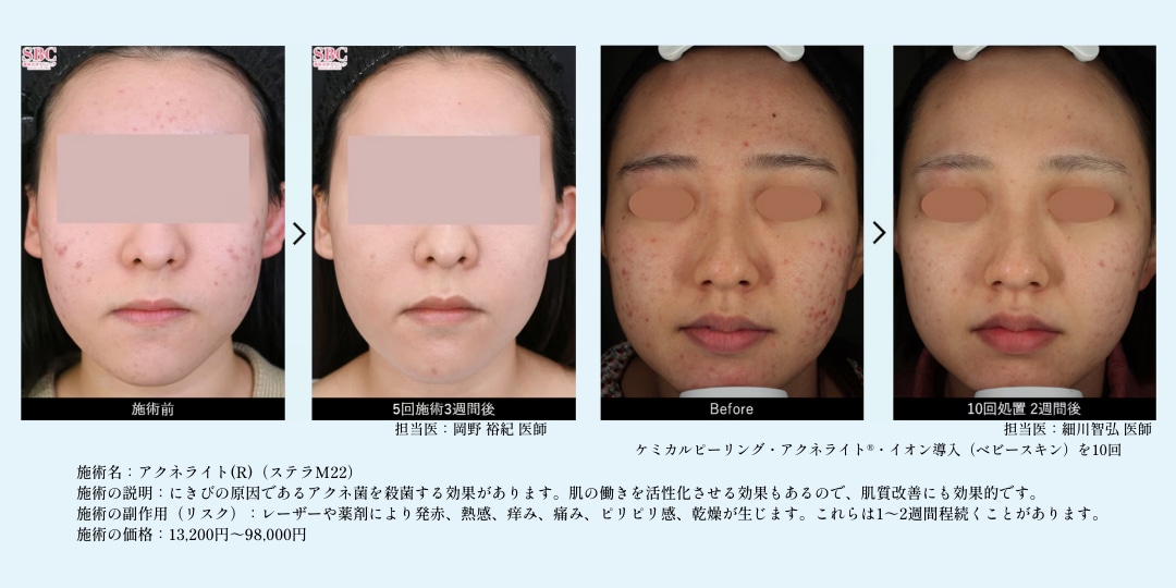 📷症例写真📷