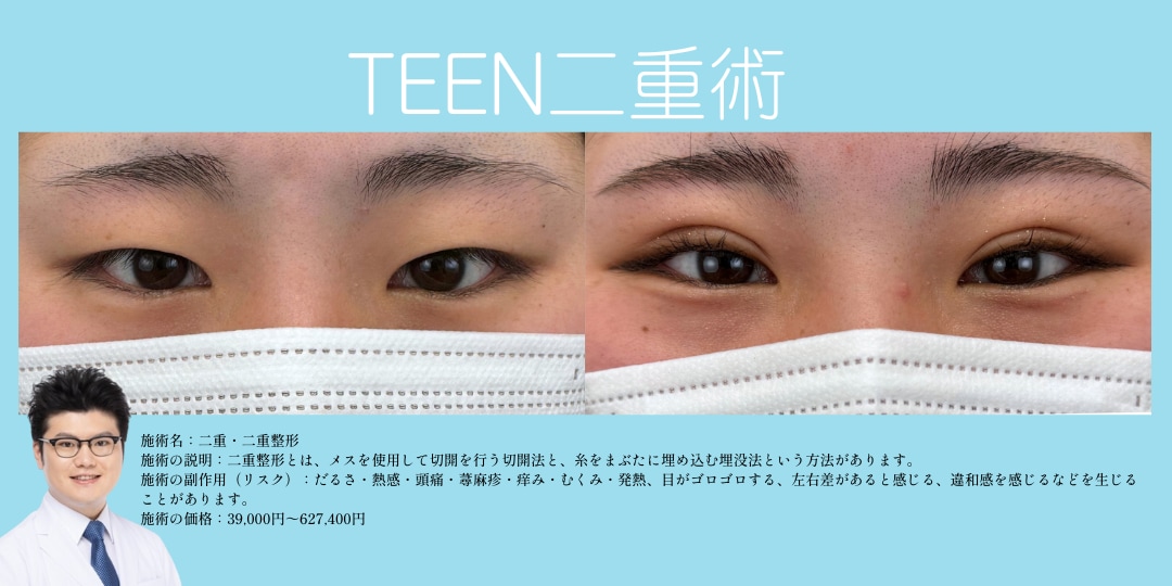 TEEN二重術