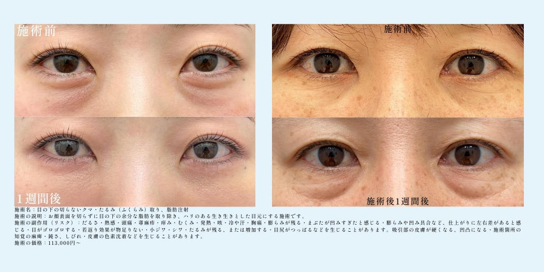 3,若返り