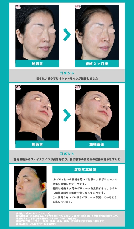 施術効果を症例でチェック!