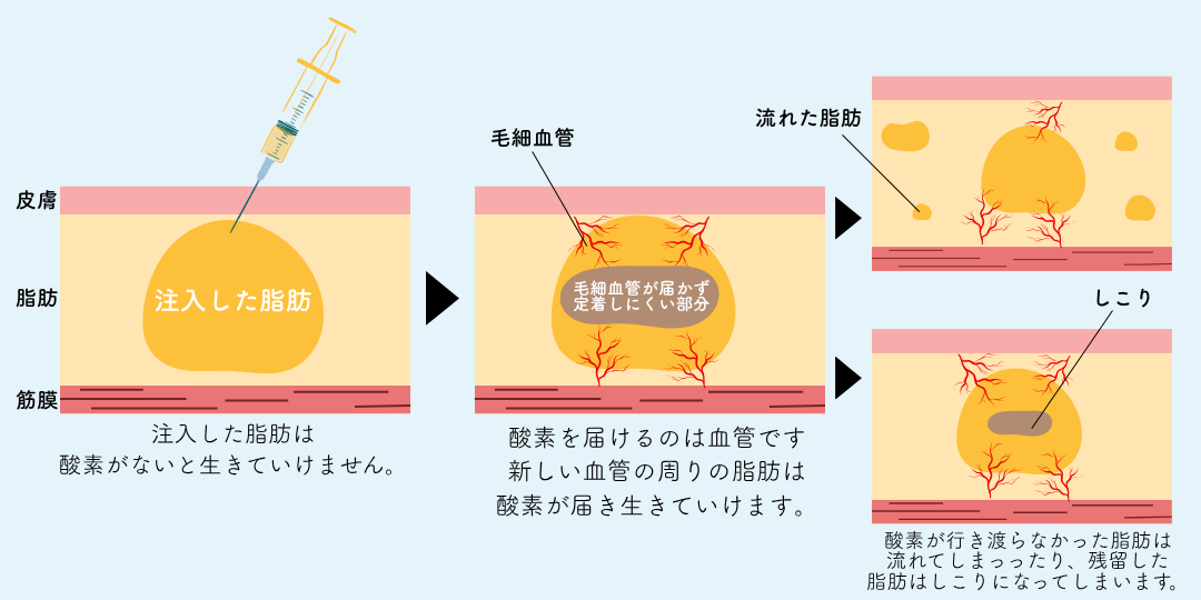 脂肪は酸素がないと生きていけない