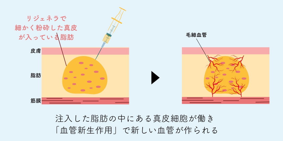 「血管新生作用」