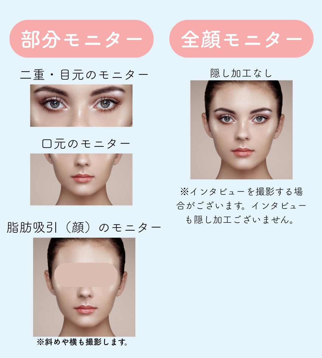 部分モニターと全顔モニターの投稿例をご紹介します