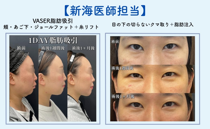 10万円以上の外科施術に使用できる【2万円チケット】配布中