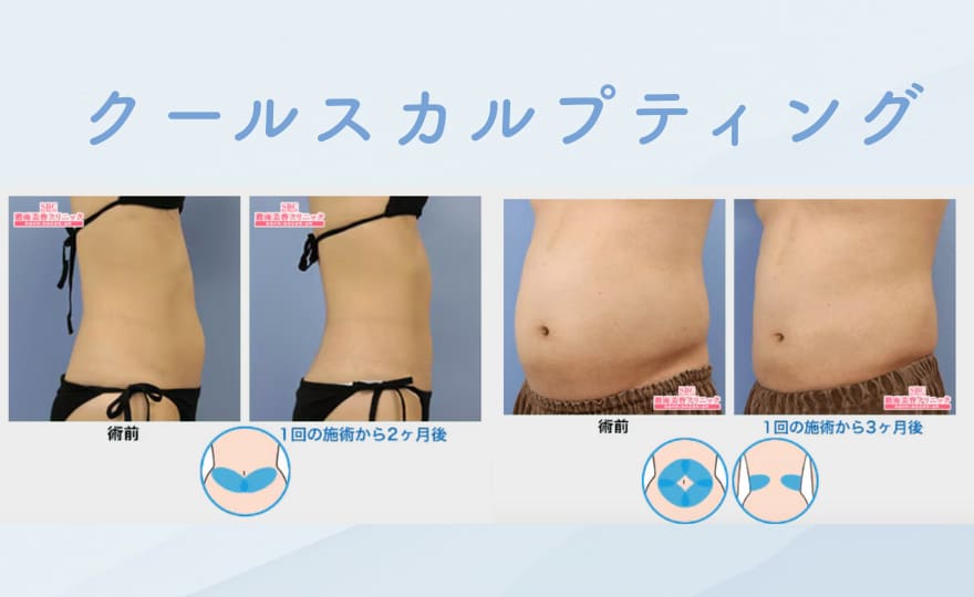 まずは施術ごとの症例写真をご覧ください‼︎<br />
